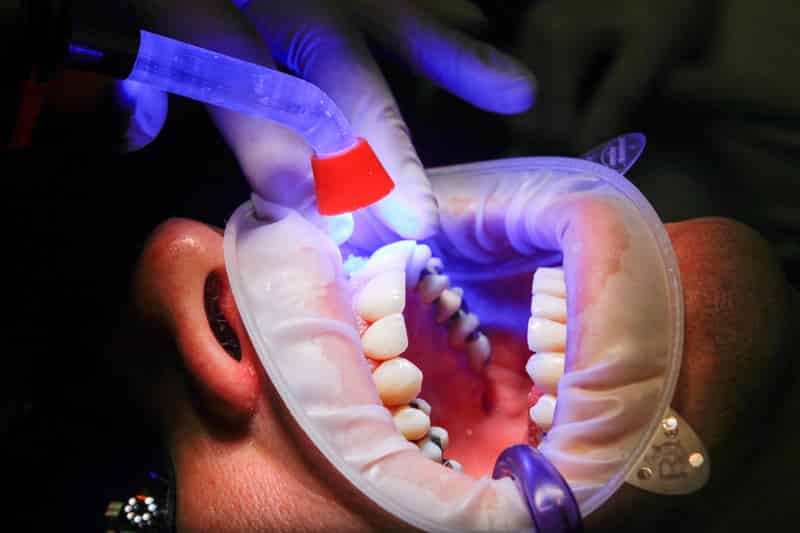 عيادات تجميل الاسنان في دبي