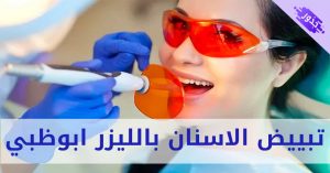 اسعار تبييض الاسنان بالليزر ابوظبي 2022